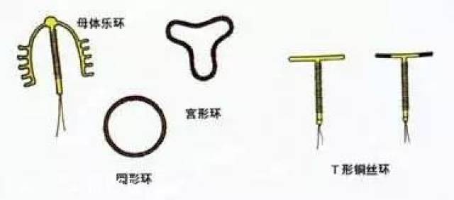 選擇指南