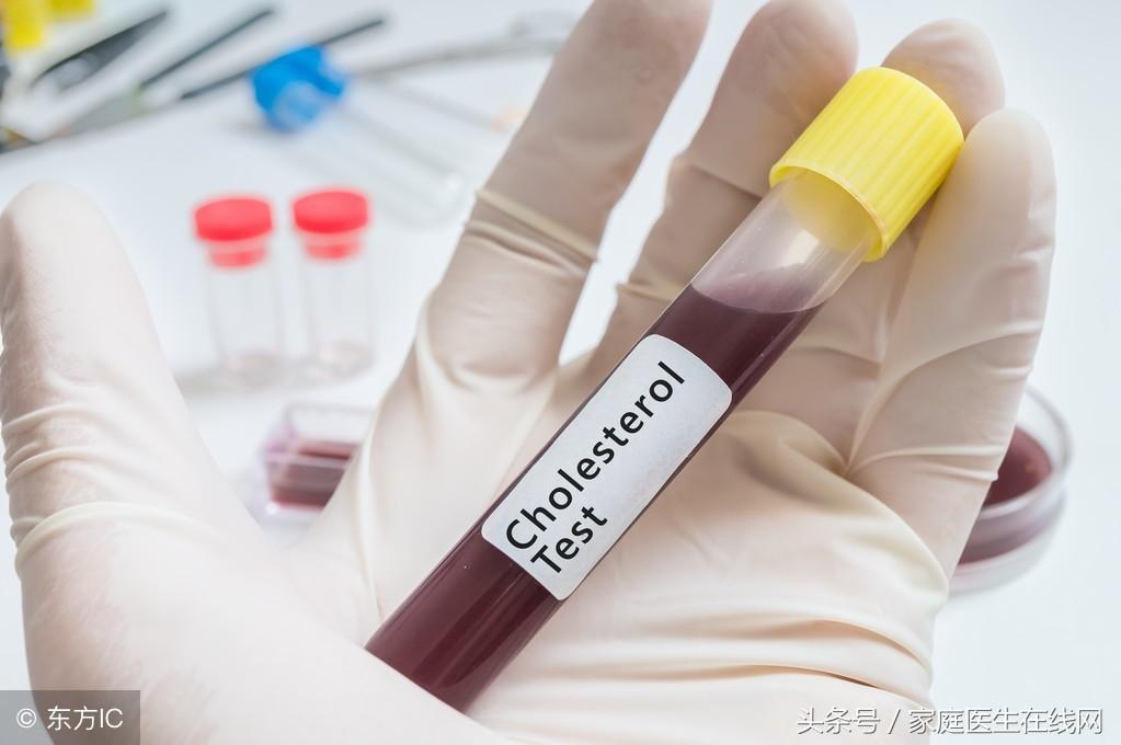 糖尿病的成因，深度解析其背后的原因，深度解析糖尿病成因，揭示背后原因真相